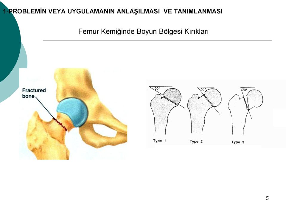 VE TANIMLANMASI Femur