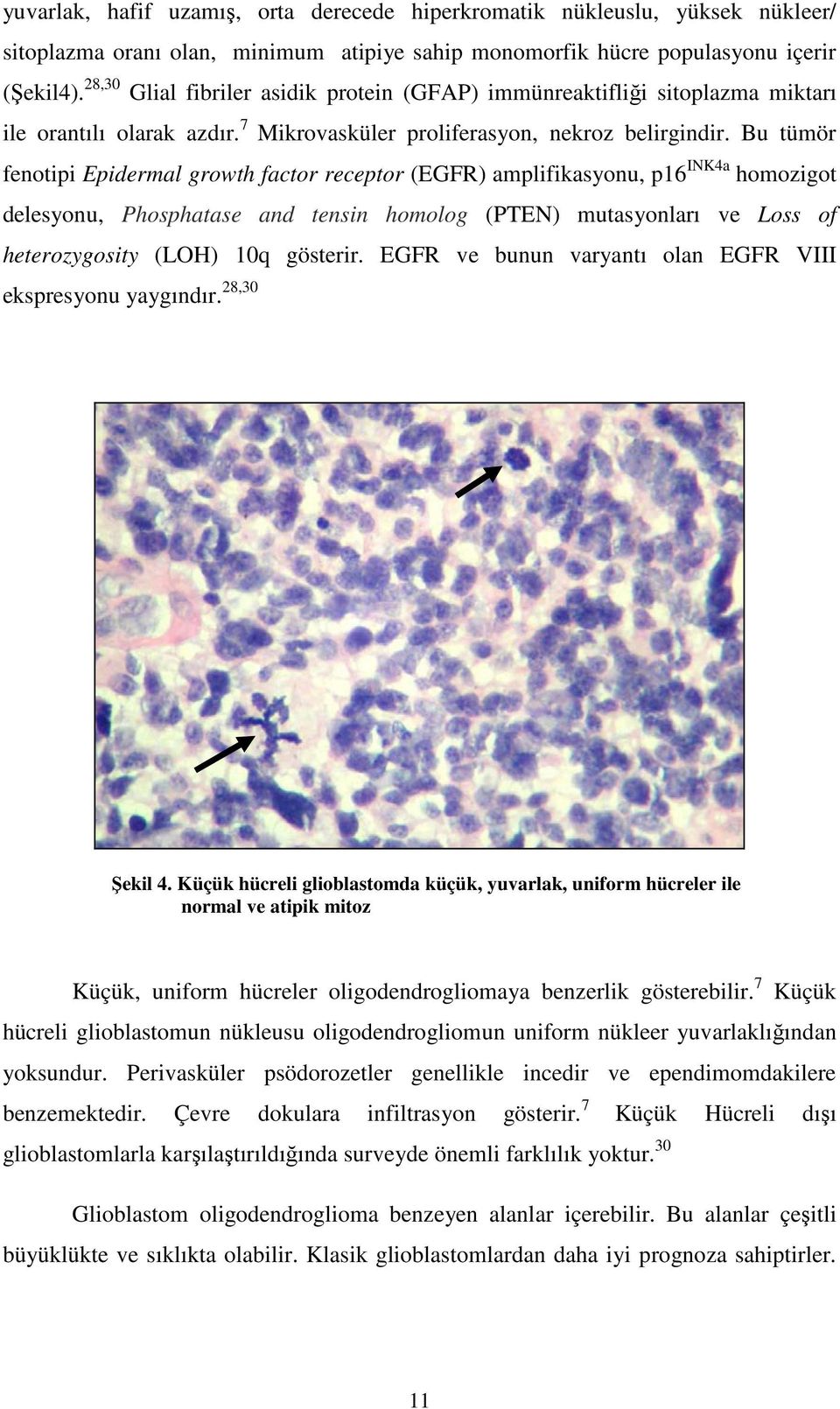 Bu tümör fenotipi Epidermal growth factor receptor (EGFR) amplifikasyonu, p16 INK4a homozigot delesyonu, Phosphatase and tensin homolog (PTEN) mutasyonları ve Loss of heterozygosity (LOH) 10q