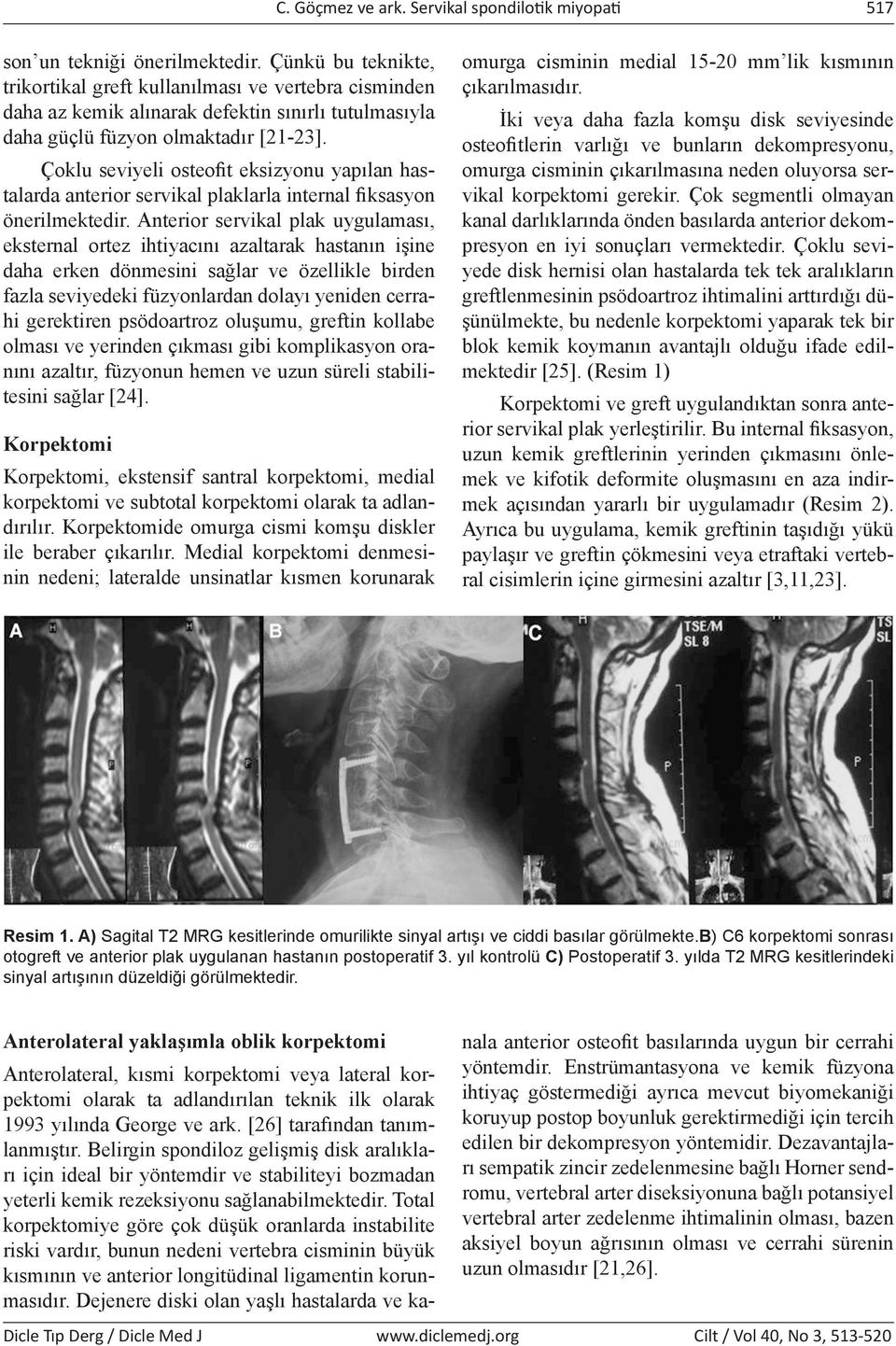 Çoklu seviyeli osteofit eksizyonu yapılan hastalarda anterior servikal plaklarla internal fiksasyon önerilmektedir.