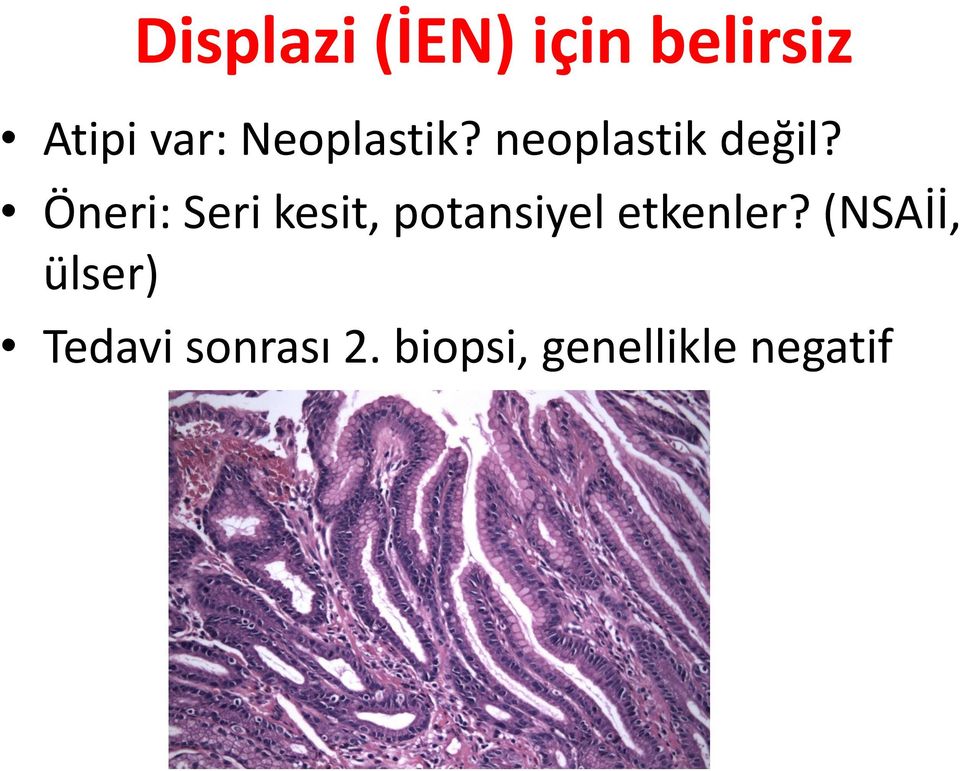 Öneri: Seri kesit, potansiyel etkenler?