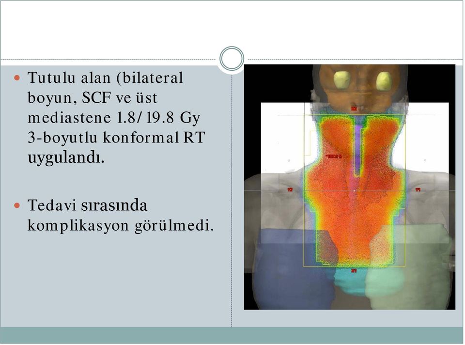 8 Gy 3-boyutlu konformal RT