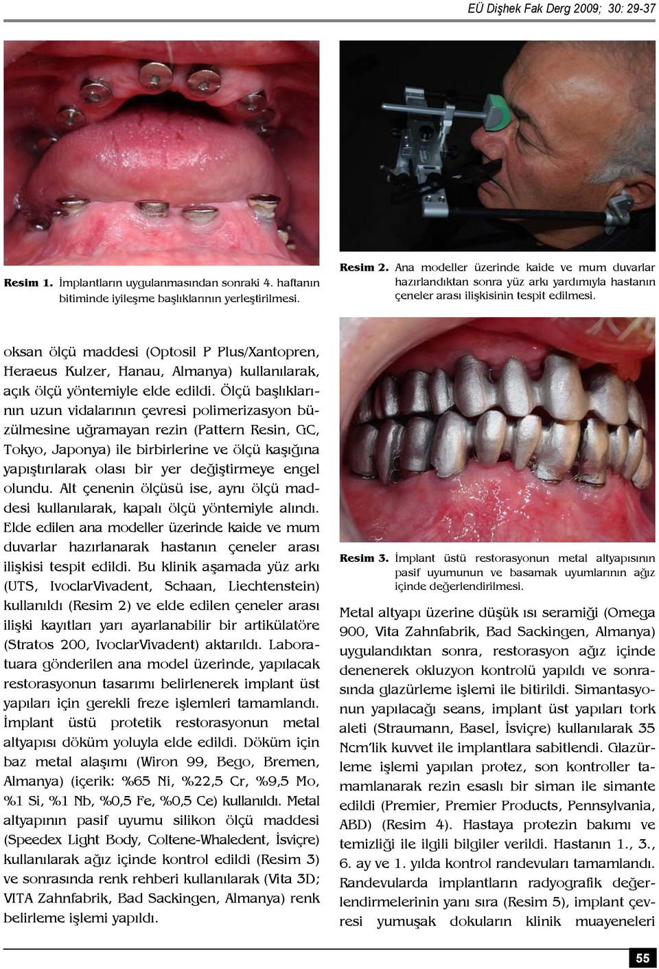 oksan ölçü maddesi (Optosil P Plus/Xantopren, Heraeus Kulzer, Hanau, Almanya) kullanılarak, açık ölçü yöntemiyle elde edildi.