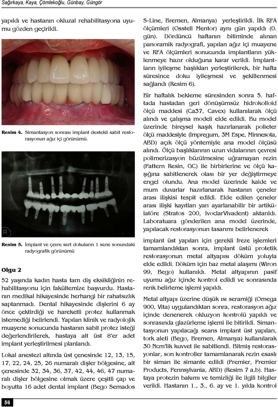 Hastanın medikal hikayesinde herhangi bir rahatsızlık saptanmadı. Dental hikayesinde dişlerini 6 ay önce çektirdiği ve hareketli protez kullanmak istemediği belirlendi.