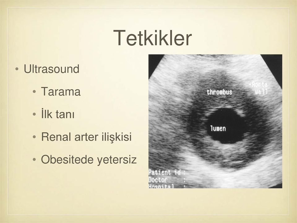 İlk tanı Renal