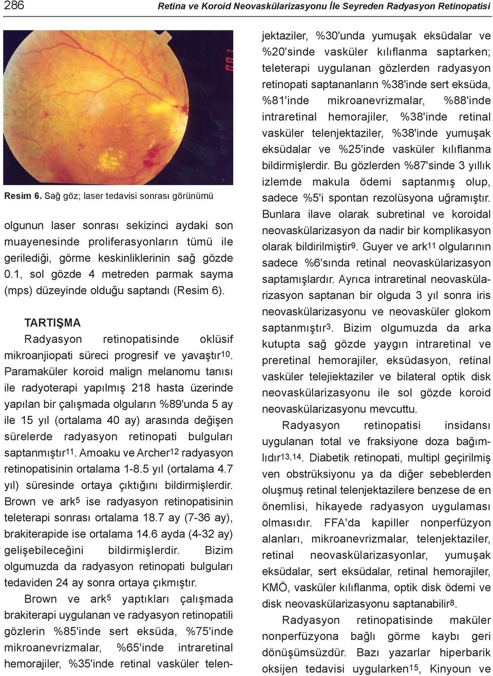 1, sol gözde 4 metreden parmak sayma (mps) düzeyinde olduðu saptandý (Resim 6). TARTIÞMA Radyasyon retinopatisinde oklüsif mikroanjiopati süreci progresif ve yavaþtýr10.