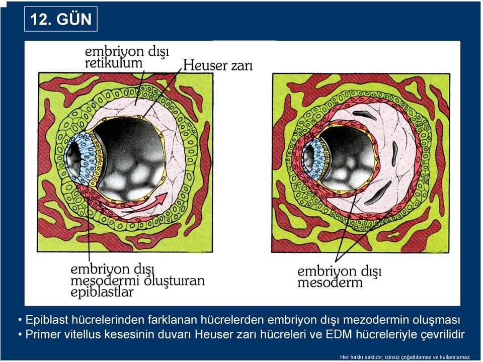 kesesinin duvarı Heuser zarı hücreleri ve EDM