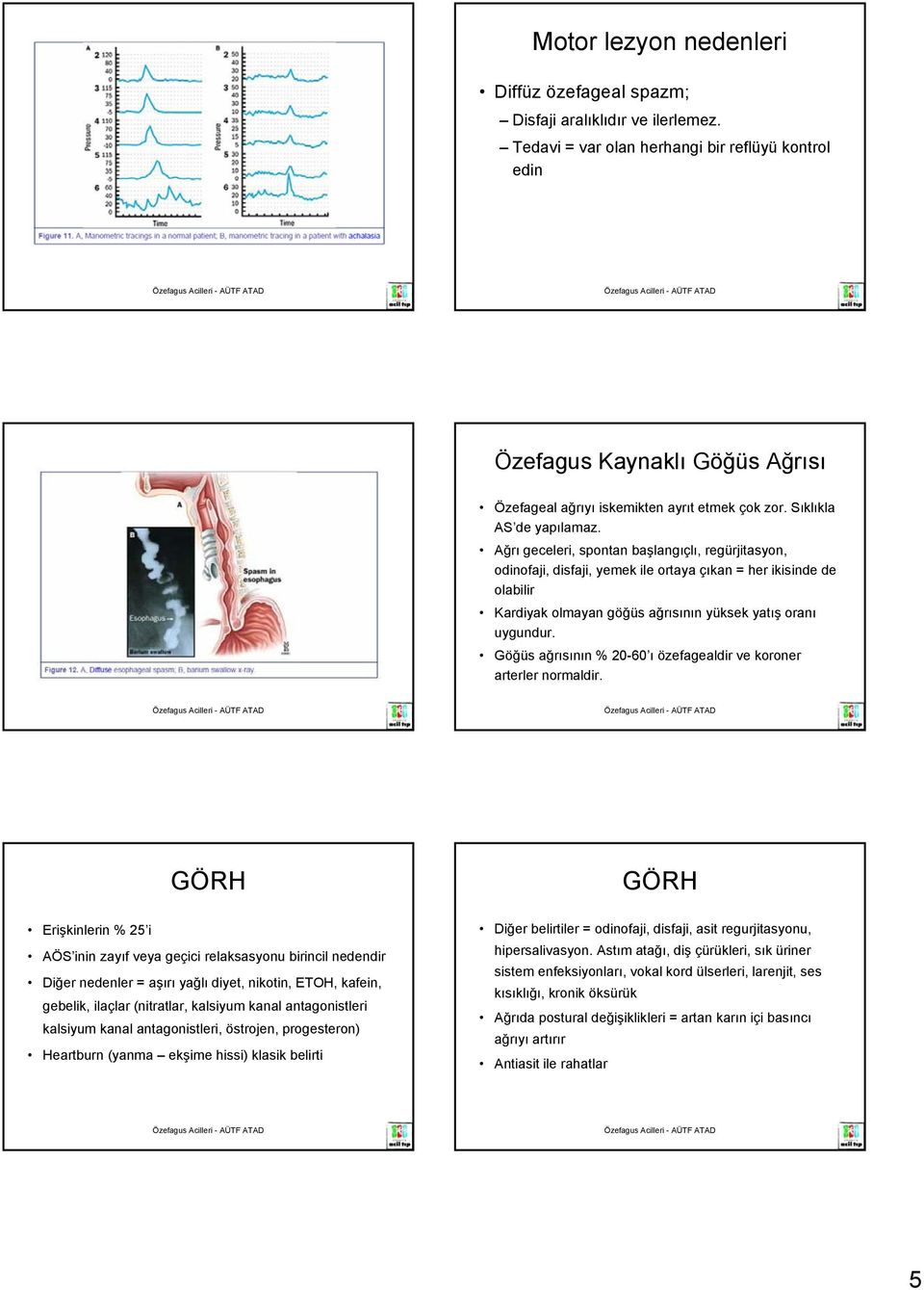 Ağrı geceleri, spontan başlangıçlı, regürjitasyon, odinofaji, disfaji, yemek ile ortaya çıkan = her ikisinde de olabilir Kardiyak olmayan göğüs ağrısının yüksek yatış oranı uygundur.