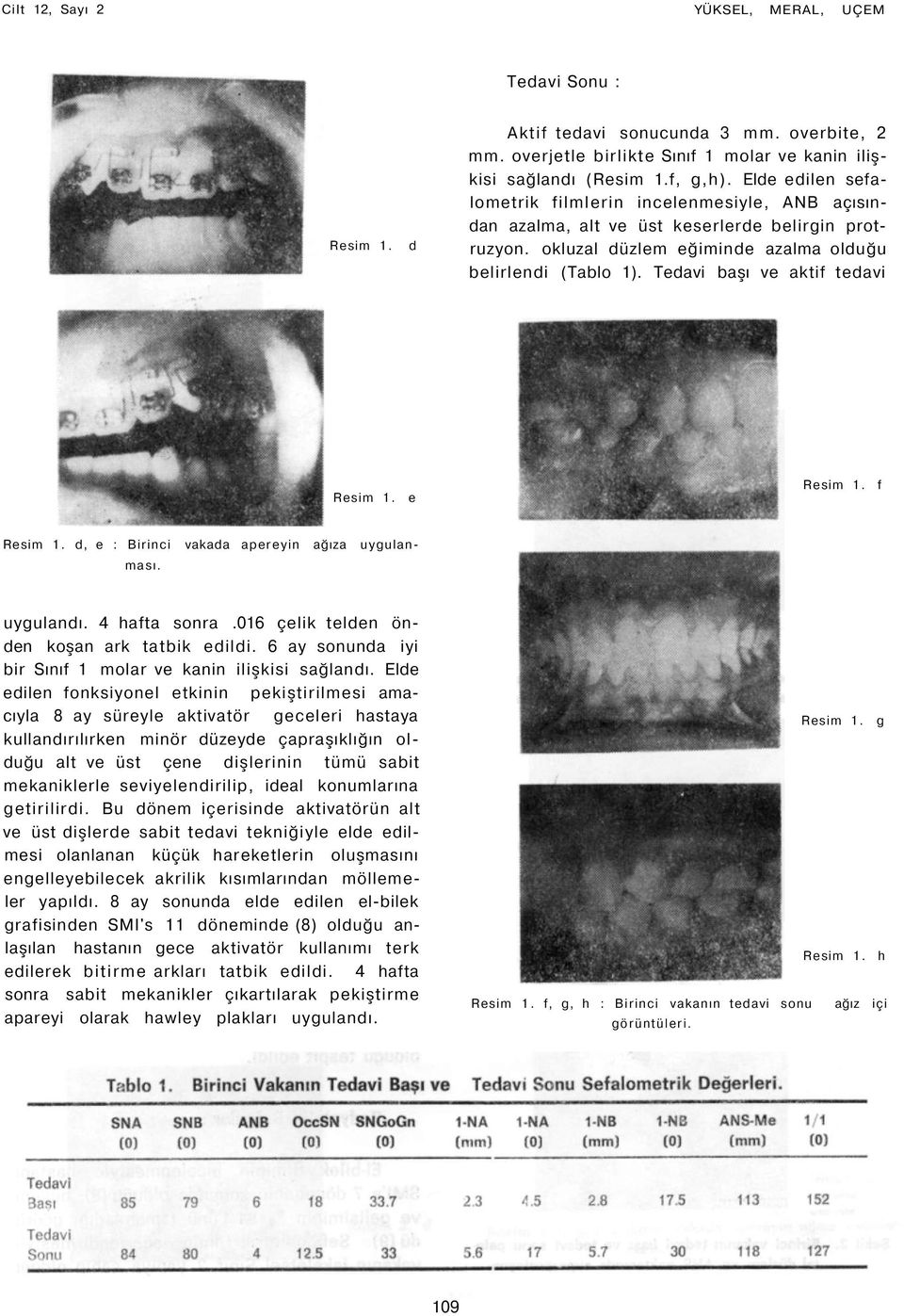 Tedavi başı ve aktif tedavi e f d, e : Birinci vakada apereyin ağıza uygulanması. uygulandı. 4 hafta sonra.016 çelik telden önden koşan ark tatbik edildi.