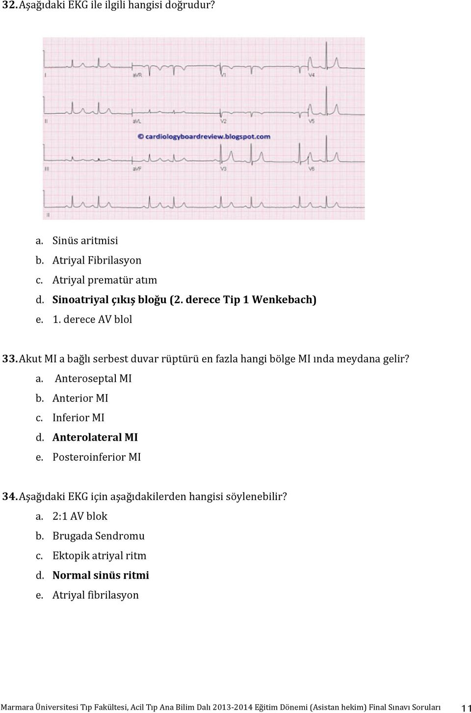 Akut MI a bağlı serbest duvar rüptürü en fazla hangi bölge MI ında meydana gelir? a. Anteroseptal MI b. Anterior MI c. Inferior MI d.