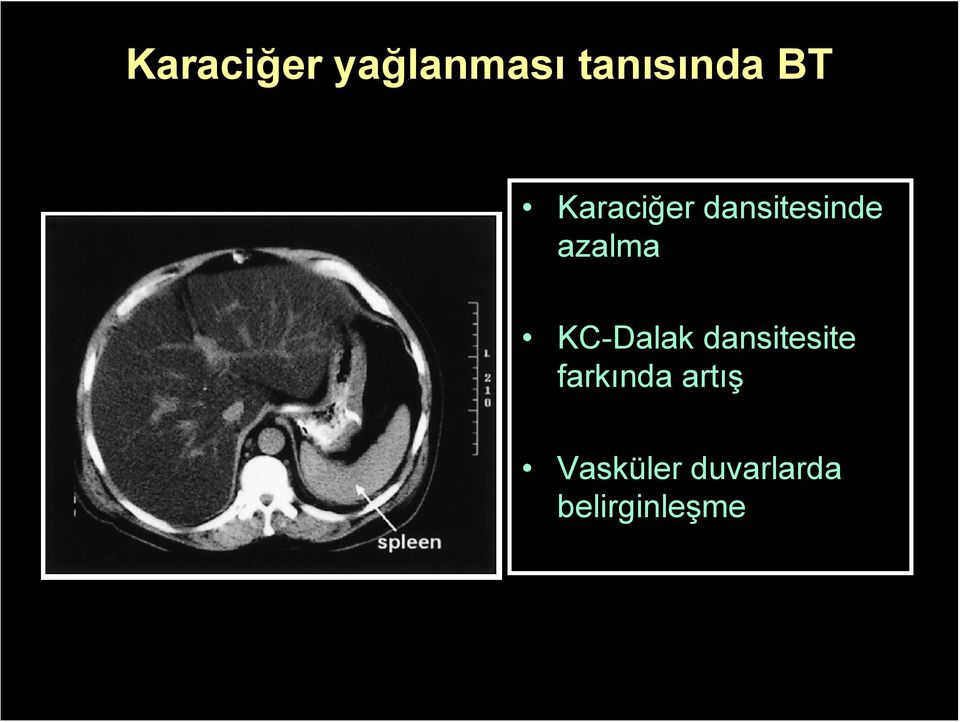 KC-Dalak dansitesite farkında