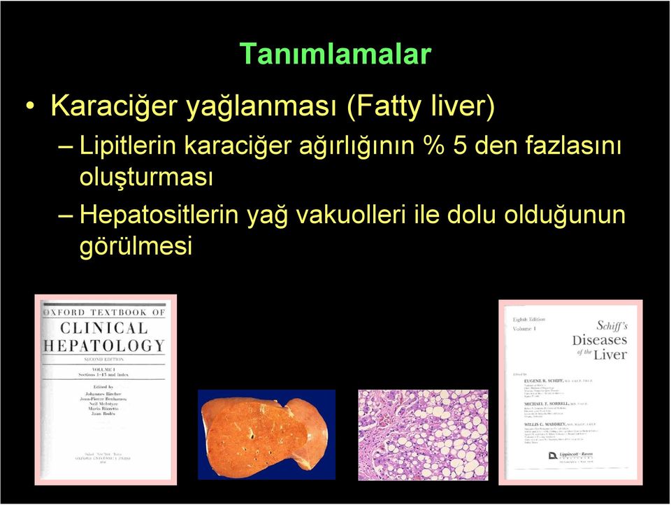 5 den fazlasını oluşturması Hepatositlerin