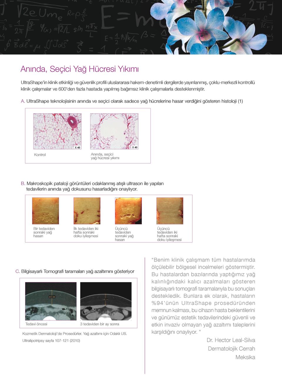 UltraShape teknolojisinin anında ve seçici olarak sadece yağ hücrelerine hasar verdiğini gösteren histoloji (1) Anında, seçici yağ hücresi yıkımı Kontrol B.