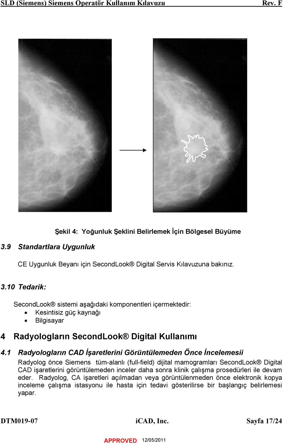 1 Radyologların CAD İşaretlerini Görüntülemeden Önce İncelemesii Radyolog önce Siemens tüm-alanlı (full-field) dijital mamogramları SecondLook Digital CAD işaretlerini görüntülemeden