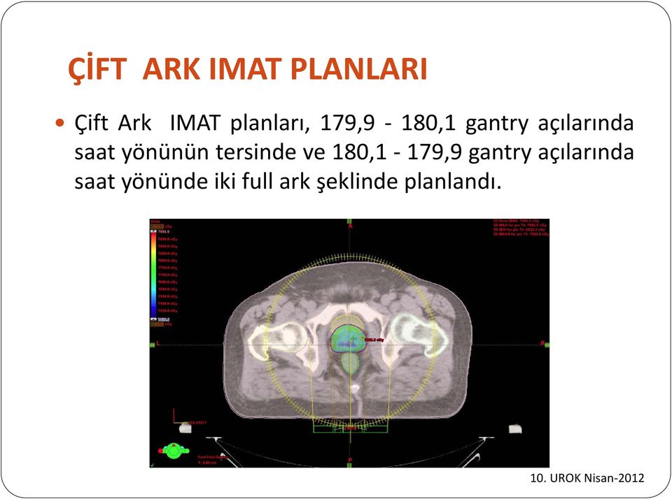 yönünün tersinde ve 180,1-179,9 gantry