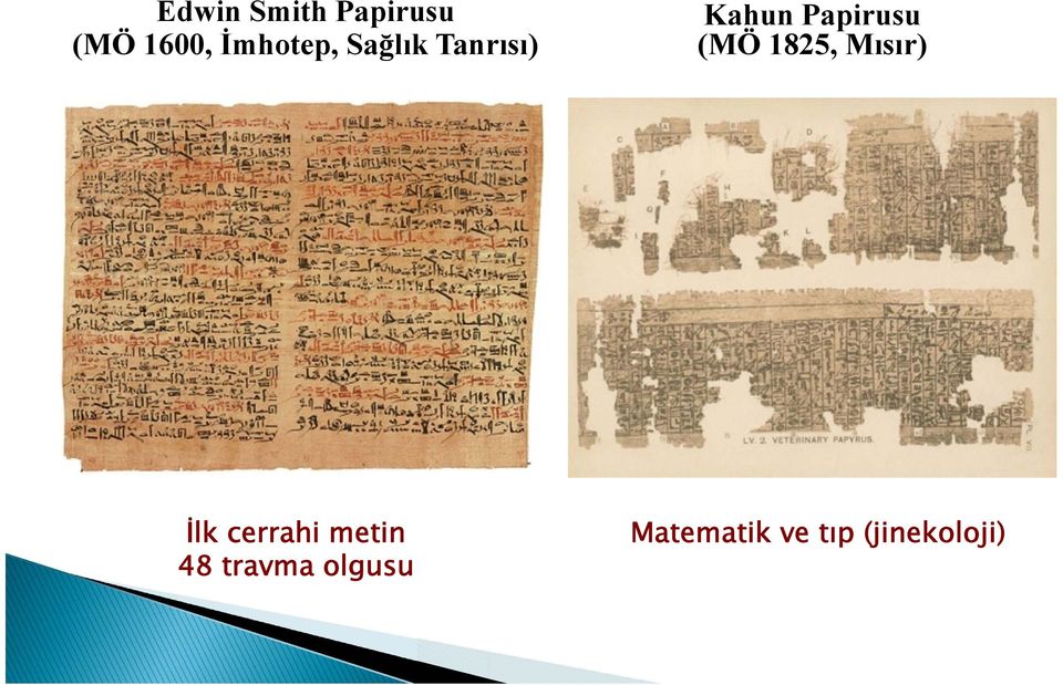 Papirusu (MÖ 1825, Mısır) İlk cerrahi