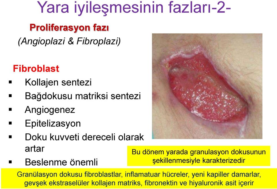 dönem yarada granulasyon dokusunun şekillenmesiyle karakterizedir Granülasyon dokusu fibroblastlar,