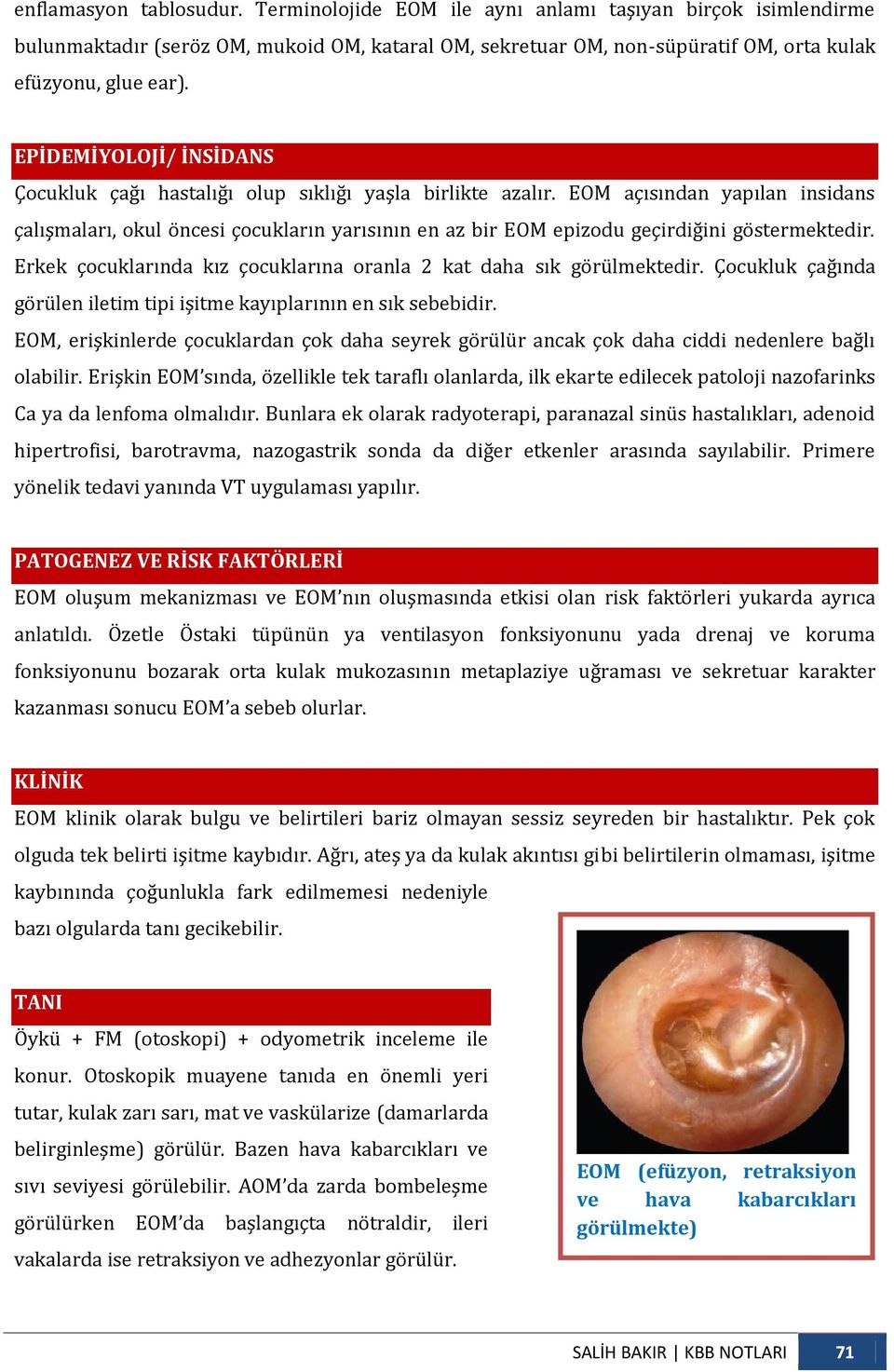 EOM açısından yapılan insidans çalışmaları, okul öncesi çocukların yarısının en az bir EOM epizodu geçirdiğini göstermektedir. Erkek çocuklarında kız çocuklarına oranla 2 kat daha sık görülmektedir.