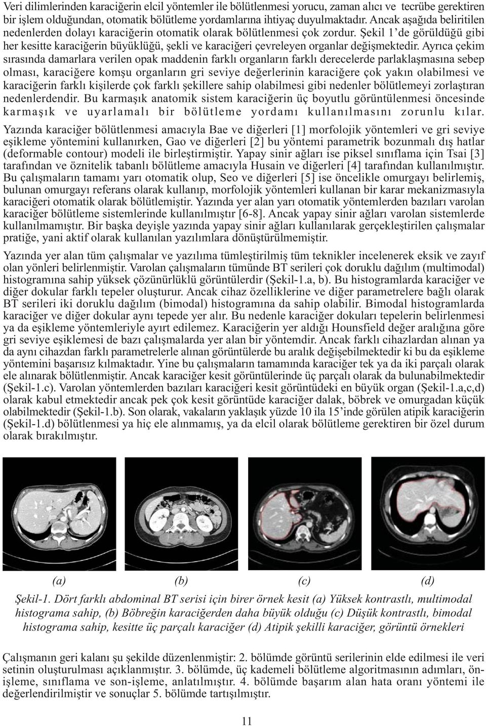 Ayrıc çekim sırsınd dmrlr verilen opk mddenin frklı orgnlrın frklı derecelerde prlklşmsın sebep olmsı, krciğere komşu orgnlrın gri seviye değerlerinin krciğere çok ykın olbilmesi ve krciğerin frklı