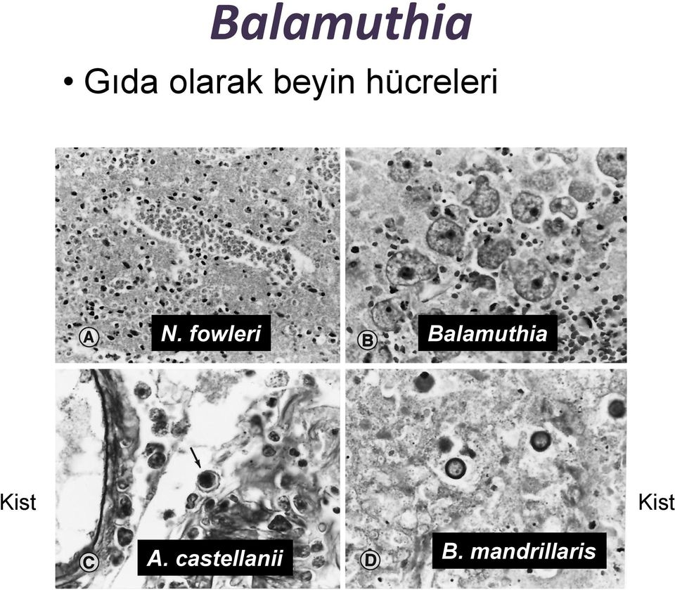 fowleri Balamuthia Kist