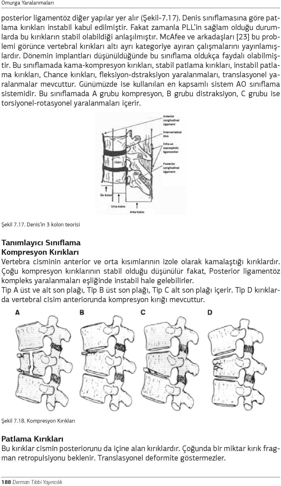 McAfee ve arkadaşları [23] bu problemi görünce vertebral kırıkları altı ayrı kategoriye ayıran çalışmalarını yayınlamışlardır.