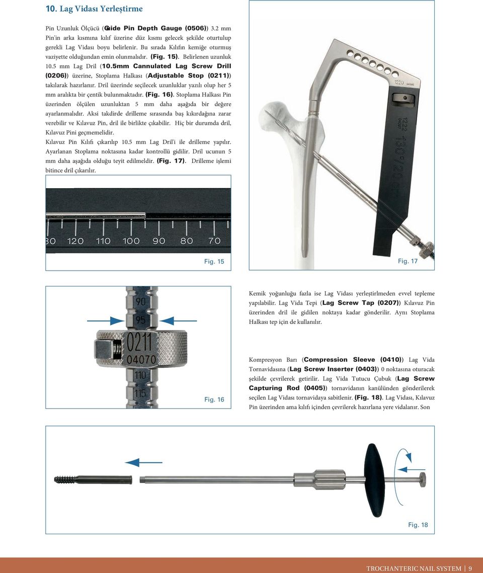 5mm Cannulated Lag Screw Drill (0206)) üzerine, Stoplama Halkası (Adjustable Stop (0211)) takılarak hazırlanır.