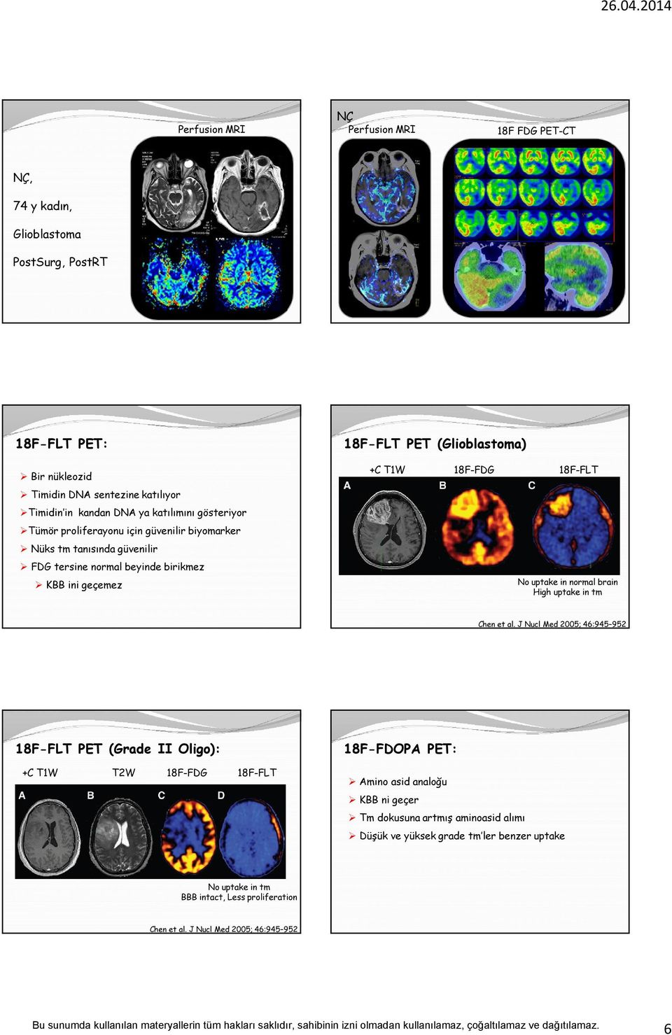 18F-FLT No uptake in normal brain High uptake in tm Chen et al.