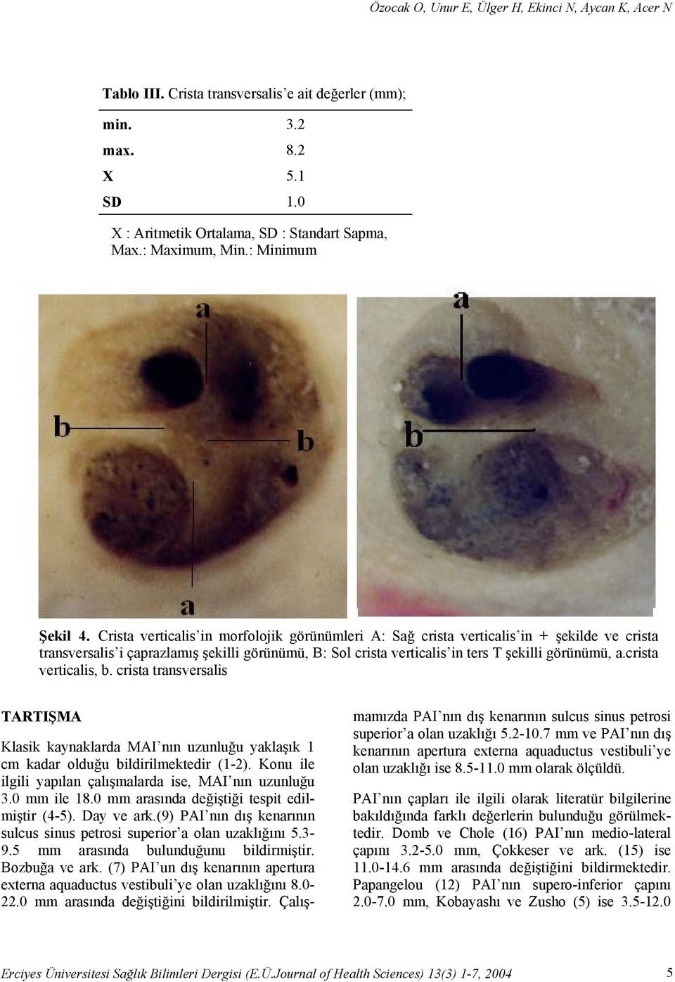 Crista verticalis in morfolojik görünümleri A: Sağ crista verticalis in + şekilde ve crista transversalis i çaprazlamış şekilli görünümü, B: Sol crista verticalis in ters T şekilli görünümü, a.