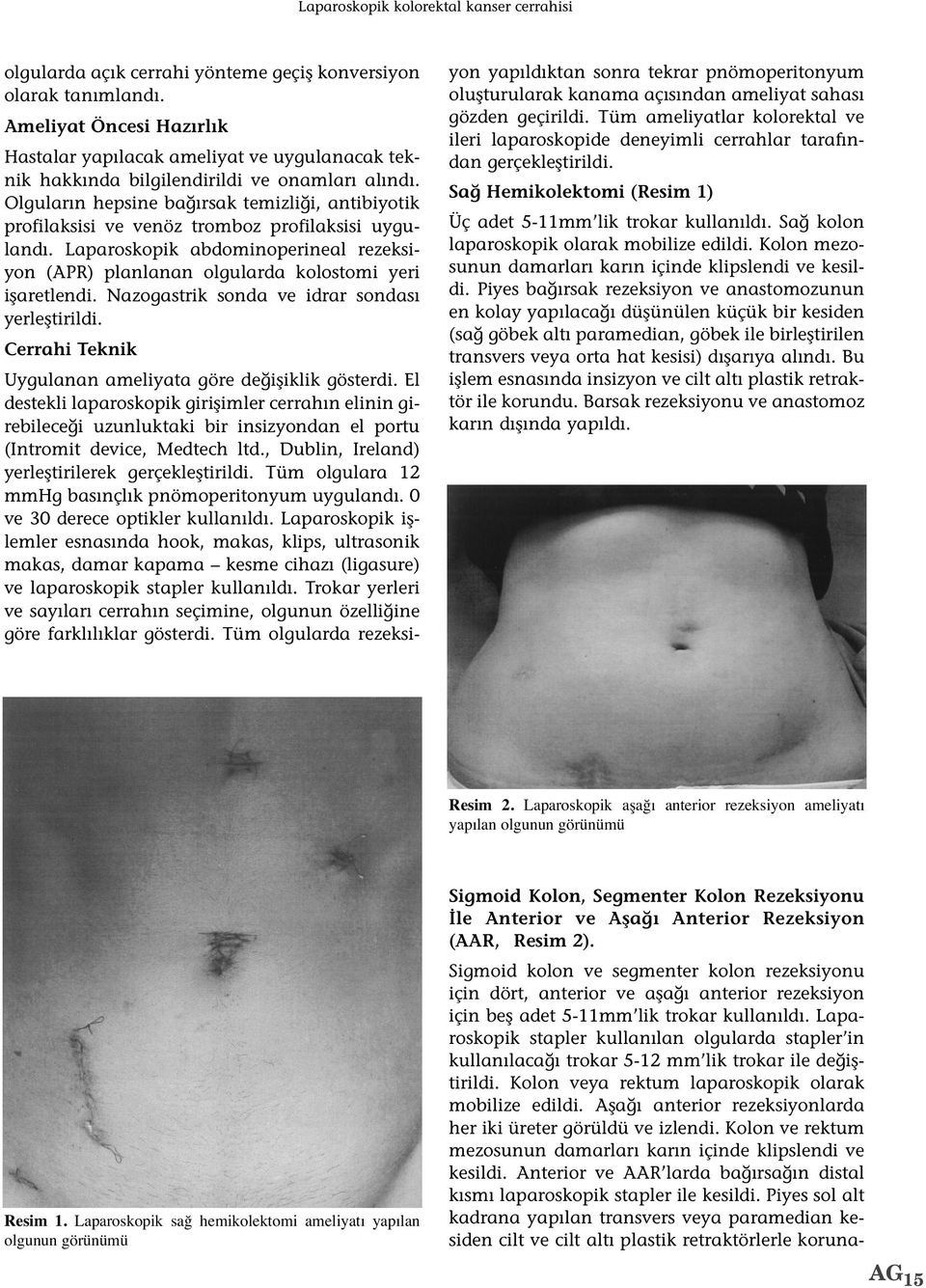 Olguların hepsine bağırsak temizliği, antibiyotik profilaksisi ve venöz tromboz profilaksisi uygulandı. Laparoskopik abdominoperineal rezeksiyon (APR) planlanan olgularda kolostomi yeri işaretlendi.