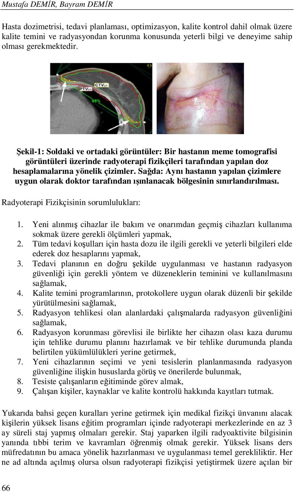 Sağda: Aynı hastanın yapılan çizimlere uygun olarak doktor tarafından ışınlanacak bölgesinin sınırlandırılması. Radyoterapi Fizikçisinin sorumlulukları: 1.