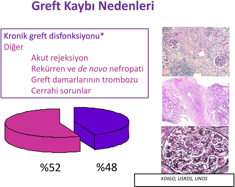 rejeksiyon Rekürren ve de novo nefropati Greft