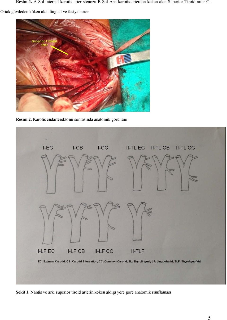 Superior Tiroid arter C- Ortak gövdeden köken alan lingual ve fasiyal arter
