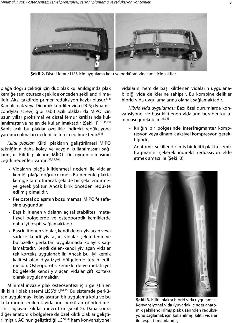 [33] Kamalı plak veya Dinamik kondiler vida (DCS; dynamic condylar screw) gibi sabit açılı plaklar da MİPO için uzun yıllar proksimal ve distal femur kırıklarında kullanılmıştır ve halen de