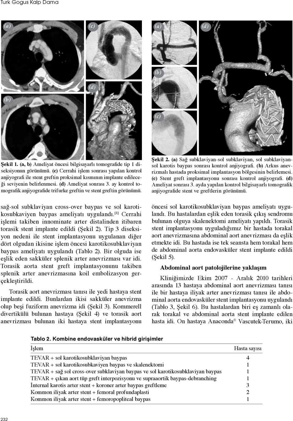 ay kontrol tomografik anjiyografide trifurke greftin ve stent greftin görünümü. sağ-sol subklaviyan cross-over baypas ve sol karotikosubkaviyen baypas ameliyatı uygulandı.