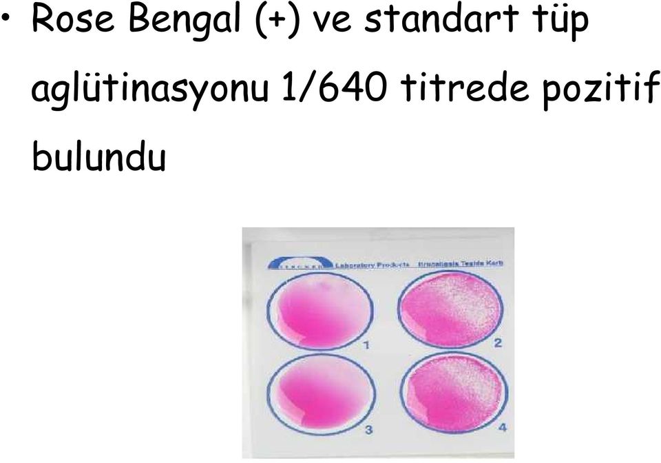 aglütinasyonu