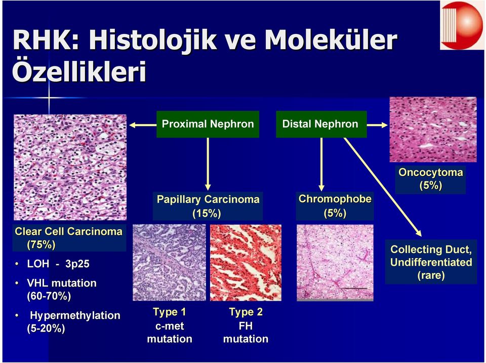 Cell Carcinoma (75%) LOH - 3p25 VHL mutation (60-70%) Hypermethylation