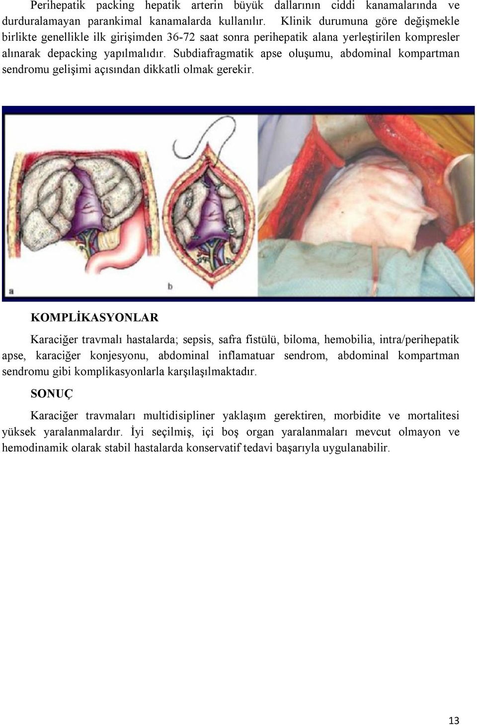 Subdiafragmatik apse oluşumu, abdominal kompartman sendromu gelişimi açısından dikkatli olmak gerekir.
