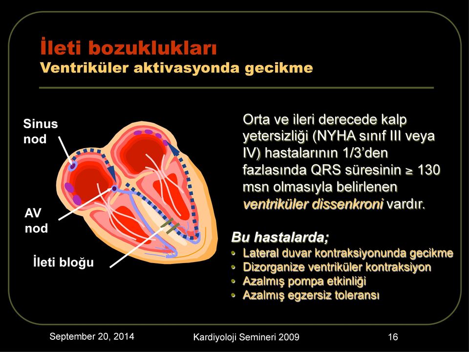 belirlenen ventriküler dissenkroni vardır.