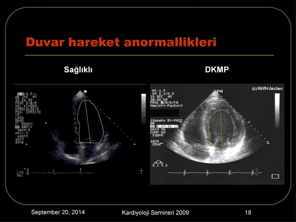 Sağlıklı DKMP