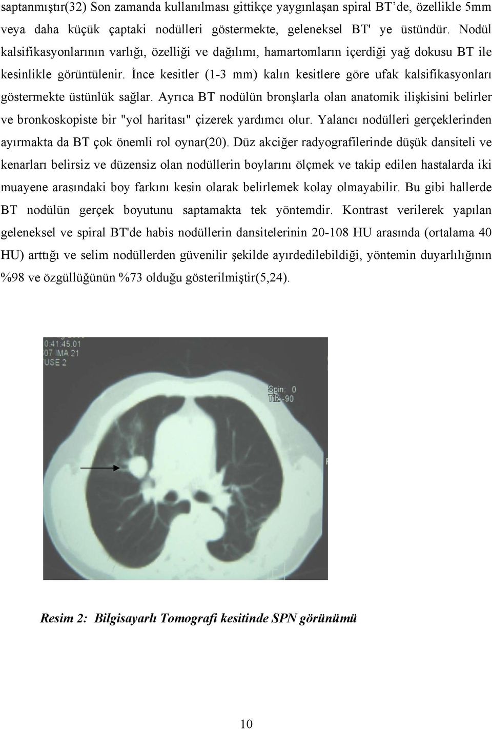 İnce kesitler (1-3 mm) kalın kesitlere göre ufak kalsifikasyonları göstermekte üstünlük sağlar.