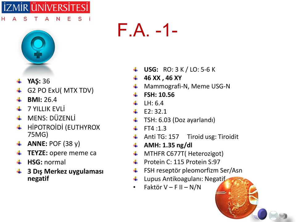 uygulaması negatif USG: RO: 3 K / LO: 5-6 K 46 XX, 46 XY Mammografi-N, Meme USG-N FSH: 10.56 LH: 6.4 E2: 32.1 TSH: 6.