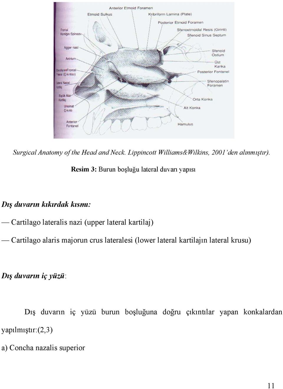 lateral kartilaj) Cartilago alaris majorun crus lateralesi (lower lateral kartilajın lateral krusu) Dış