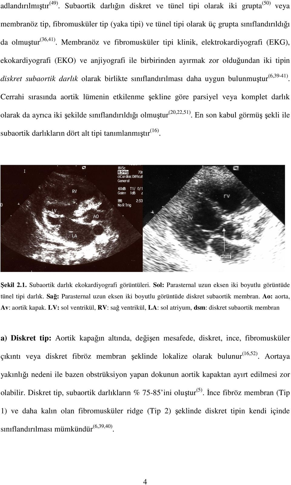 Membranöz ve fibromusküler tipi klinik, elektrokardiyografi (EKG), ekokardiyografi (EKO) ve anjiyografi ile birbirinden ayırmak zor olduğundan iki tipin diskret subaortik darlık olarak birlikte