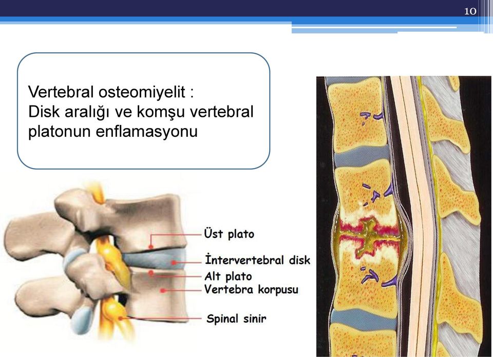 aralığı ve komşu