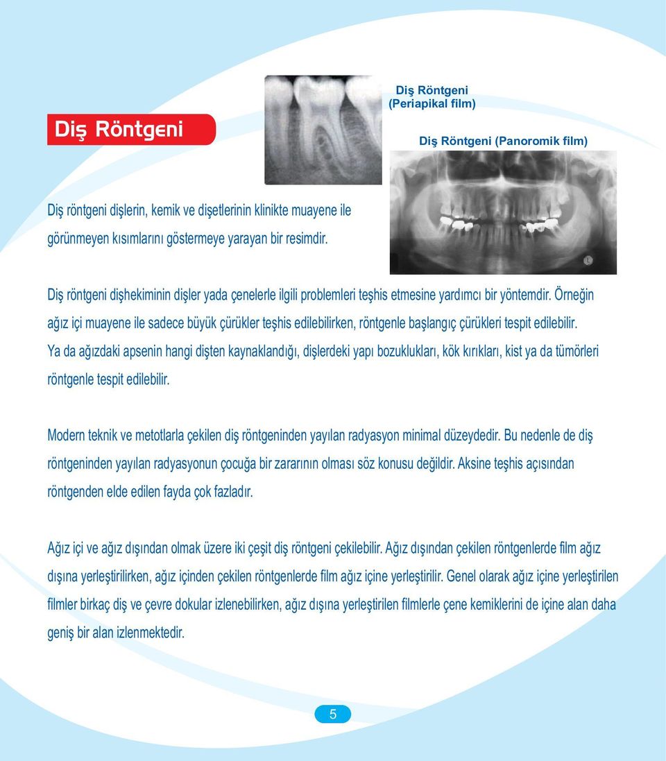 Örneðin aðýz içi muayene ile sadece büyük çürükler teþhis edilebilirken, röntgenle baþlangýç çürükleri tespit edilebilir.