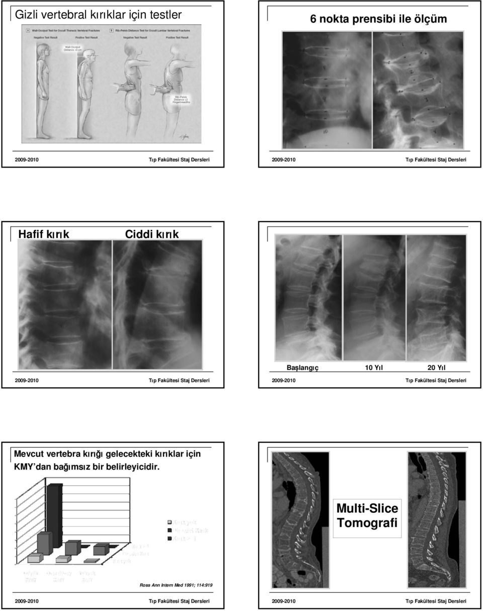 vertebra kırığı gelecekteki kırıklar için KMY dan bağımsız bir