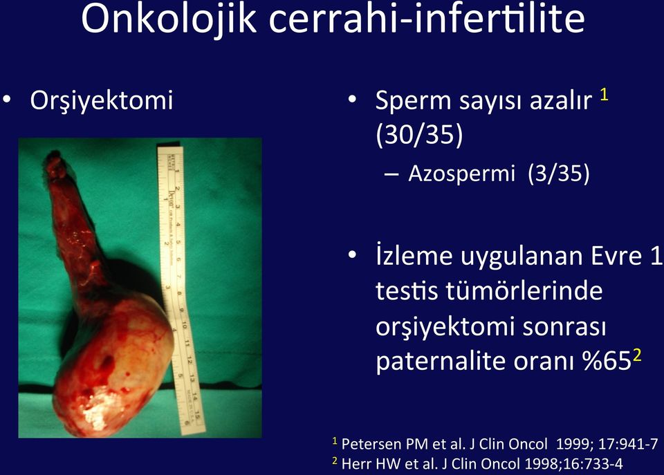 tümörlerinde orşiyektomi sonrası paternalite oranı %65 2 1