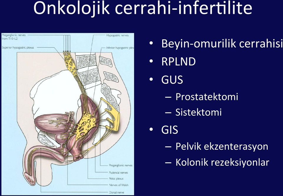 GUS Prostatektomi Sistektomi GIS