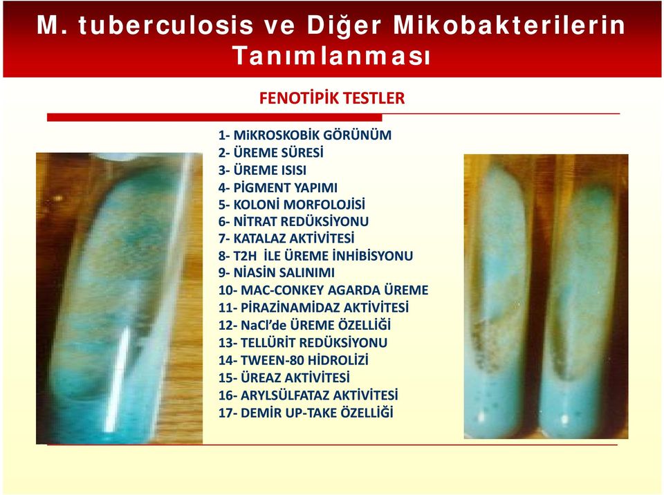 SALINIMI 10-- MAC 10 MAC--CONKEY AGARDA ÜREME 11-- PİRAZİNAMİDAZ AKTİVİTESİ 11 12-- NaCl de ÜREME ÖZELLİĞİ 12 13-- TELLÜRİT