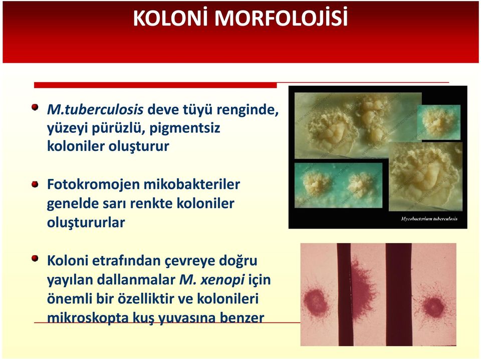 oluşturur Fotokromojen mikobakteriler genelde sarı renkte koloniler