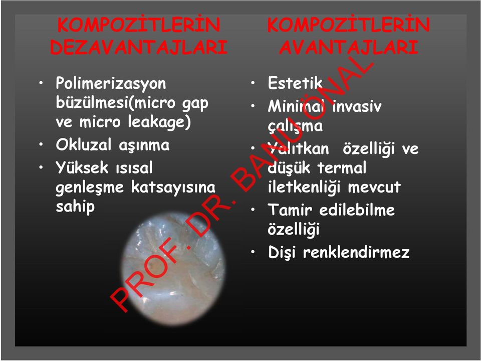 KOMPOZİTLERİN AVANTAJLARI Estetik Minimal invasiv çalışma Yalıtkan